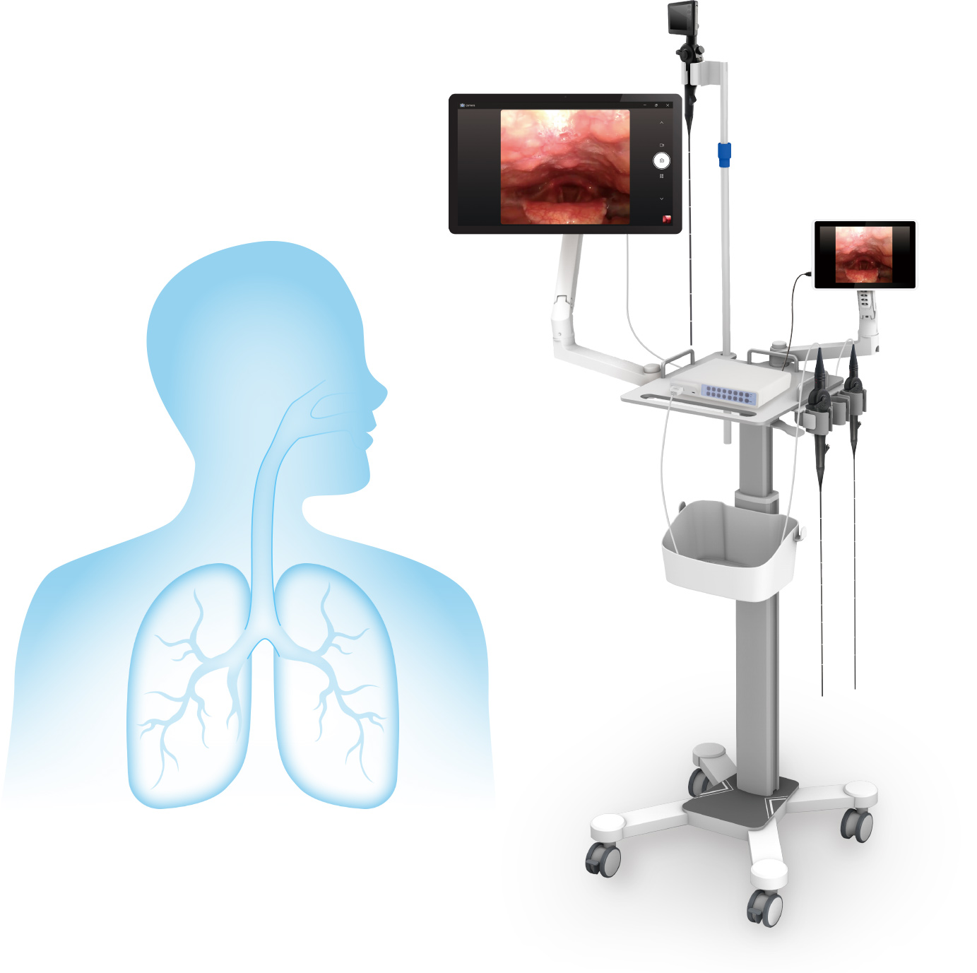 airway management