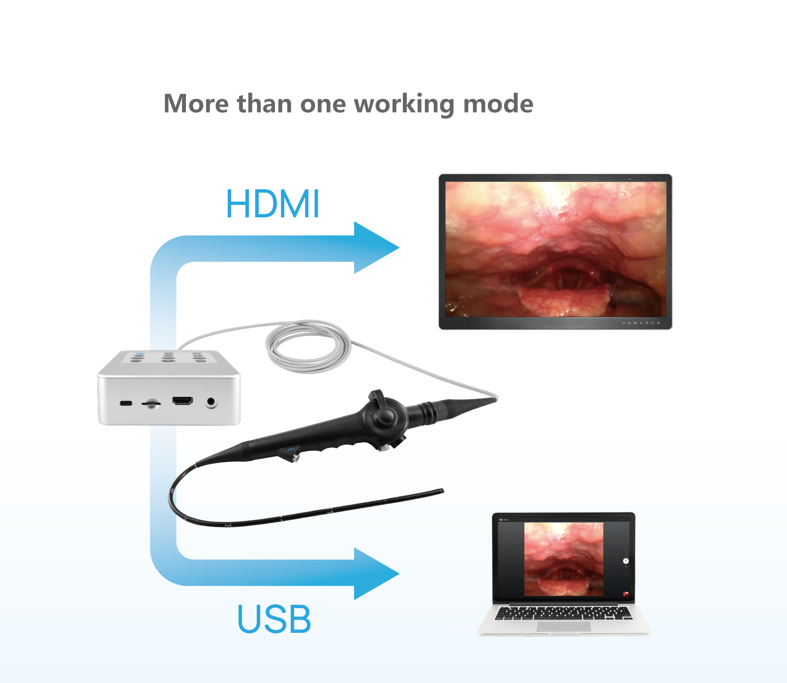 Video Flexible Nasopharyngoscope M3E