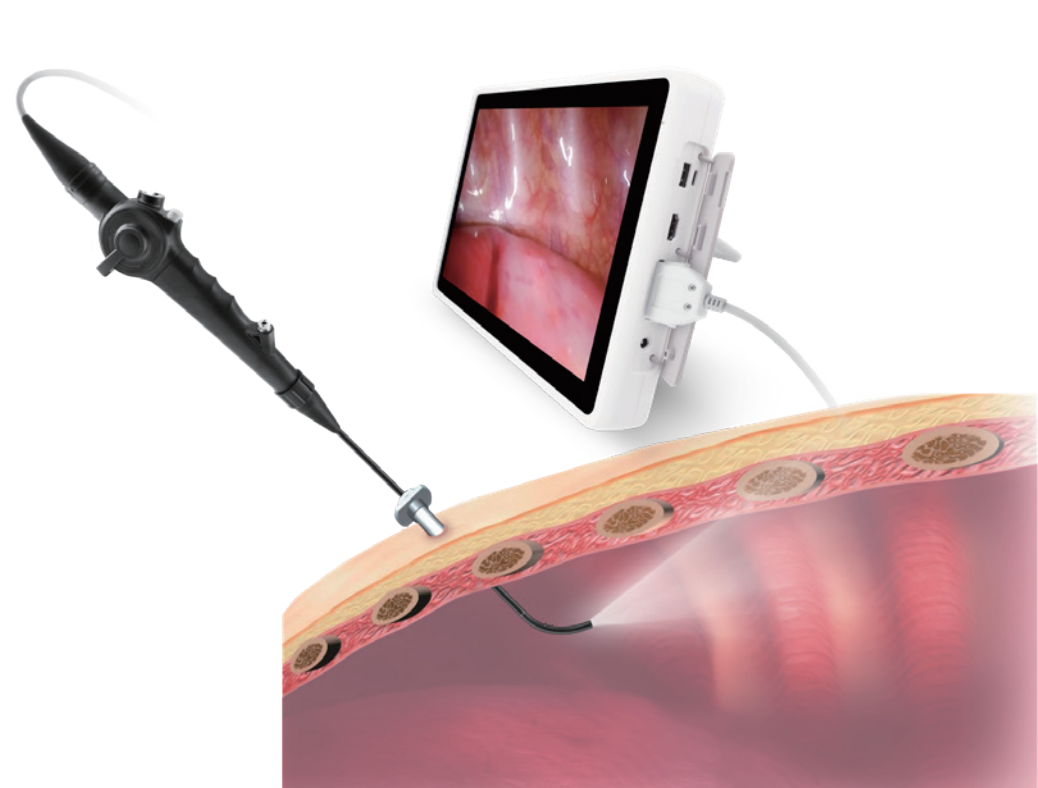 Video Pleuroscope, TAS series