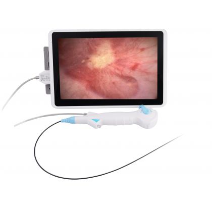 Disposable Flexible Ureteroscope, DUR